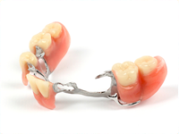 Corson Dentistry partials